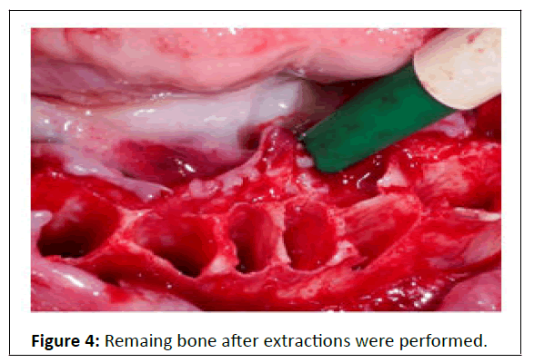 medical-case-remaing