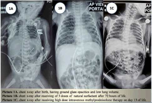medical-case-reports-chest