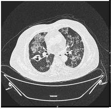 medical-case-score