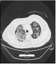 medical-case-score(b)