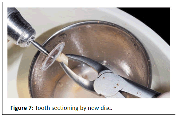 medical-case-sectioning