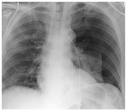 medical-case-sided