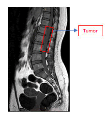 medical-case-spine