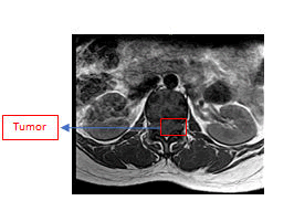 medical-case-spine