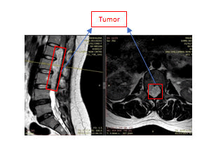 medical-case-spine