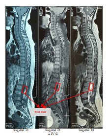 medical-case-spine