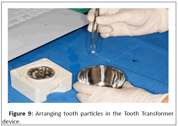 medical-case-tooth