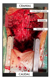 medical-case-tumor