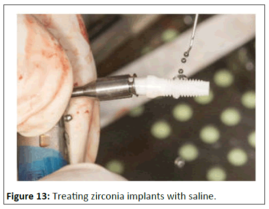 medical-case-zirconia