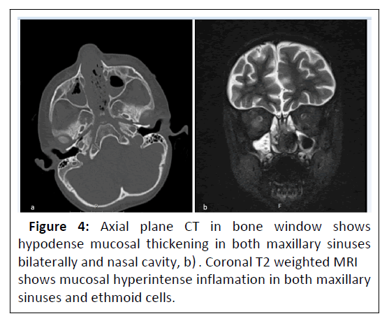 medical-physics-maxillary