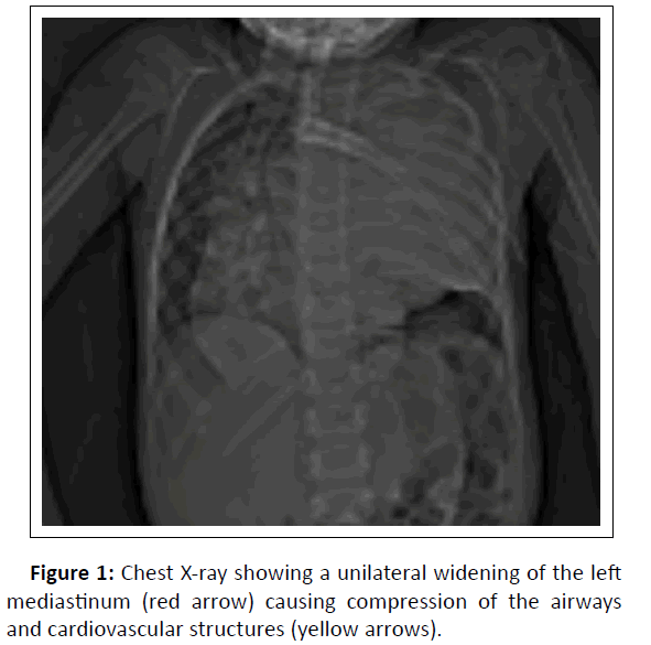 medical-unilateral