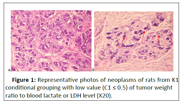 neoplasm-representative