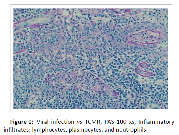 nephrology-inflammatory