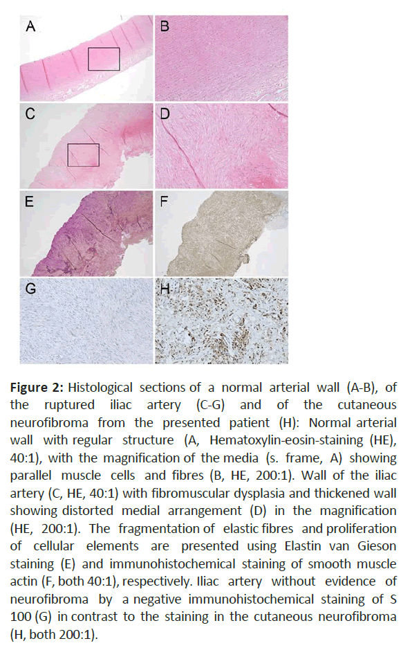 rare-disorders-histological