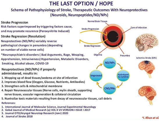 stroke-research-pathophysiology