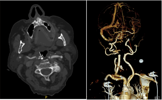 vascular-endovascular-preoperative