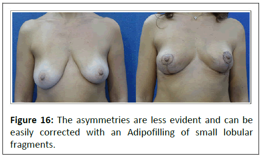 aesthetic-reconstructive-asymmetries