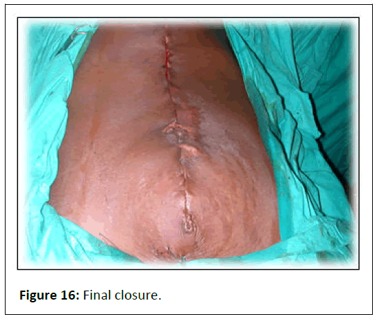 aesthetic-reconstructive-final-closure