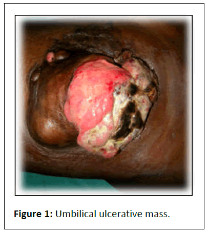 aesthetic-reconstructive-ulcerative