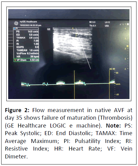 clinical-experimental-thrombosis