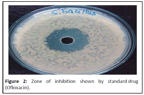 ipctn-Zone