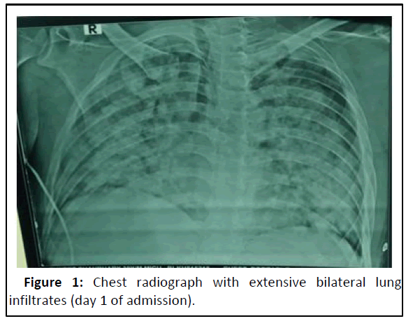 ipjcmt-Chest