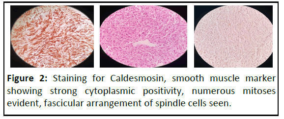 ipmo-Staining