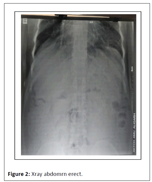 medical-case-abdomrn