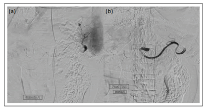 medical-case-angiography