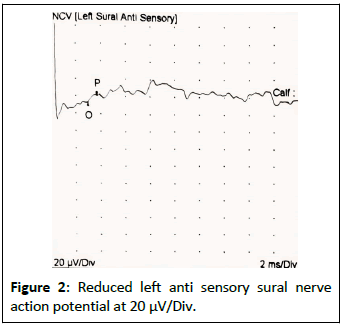 medical-case-anti-sensory