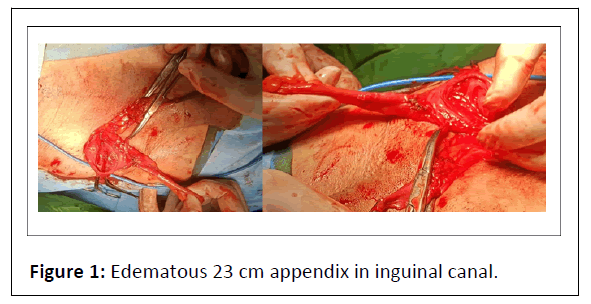 medical-case-appendix