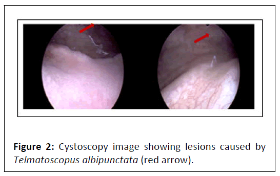 medical-case-cystoscopy