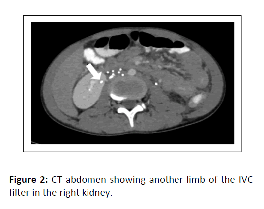 medical-case-kidney