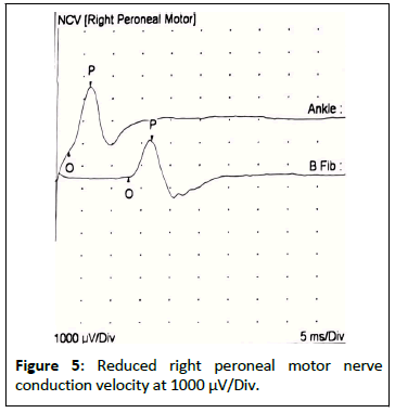 medical-case-motor-nerve