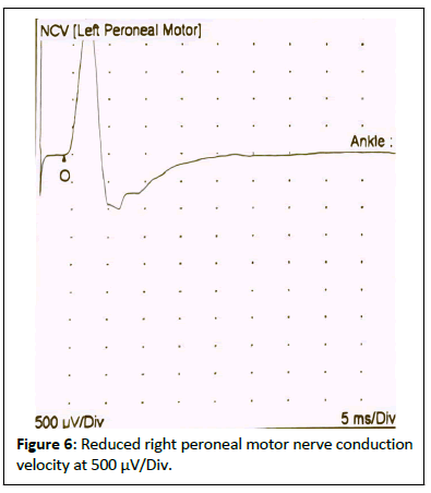 medical-case-reduced-right