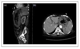 medical-case-tomography