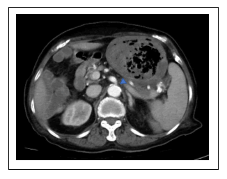 medical-case-tomography