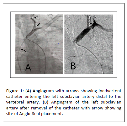 vascular-angiogram