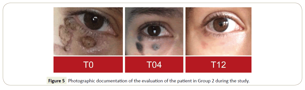 skin-diseases-skin-care-group-allocation