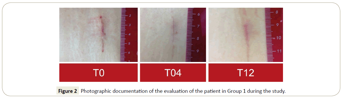 skin-diseases-skin-care-participant-enrollment
