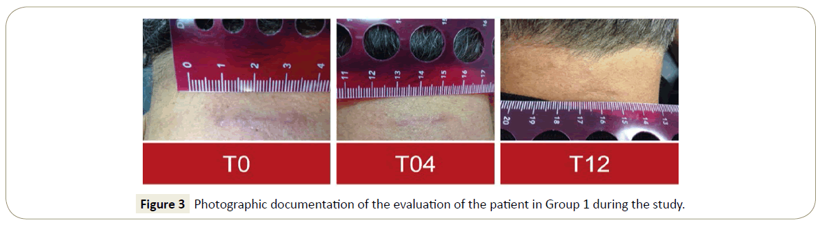 skin-diseases-skin-care-participant-enrollment