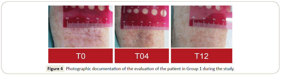 skin-diseases-skin-care-participant-enrollment