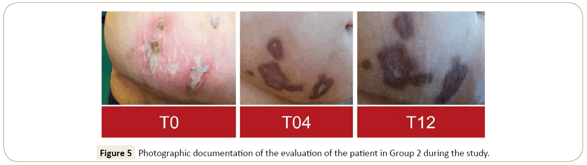 skin-diseases-skin-care-participant-enrollment