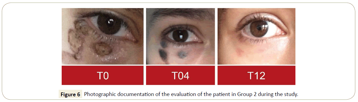 skin-diseases-skin-care-participant-enrollment