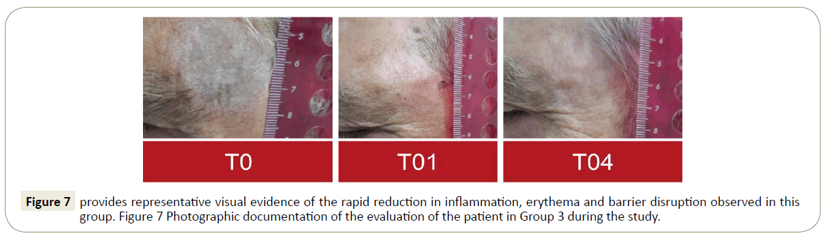 skin-diseases-skin-care-participant-enrollment