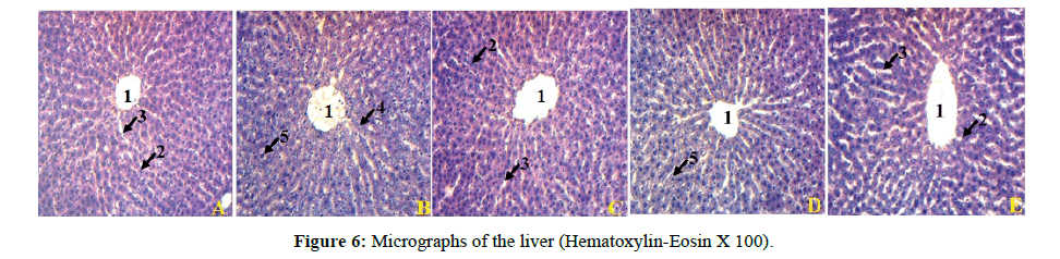 Annals-of-Biological-liver