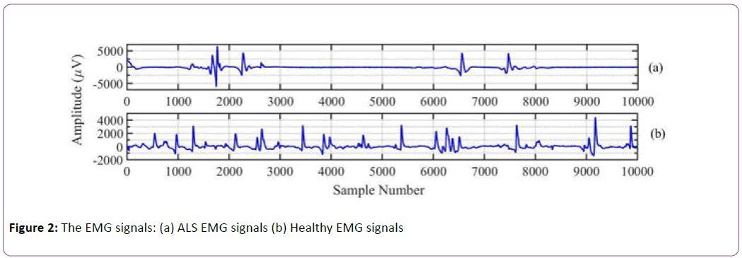 Information-Technology-EMG-signals