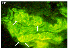 ganglia