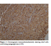 immunohistochemistry