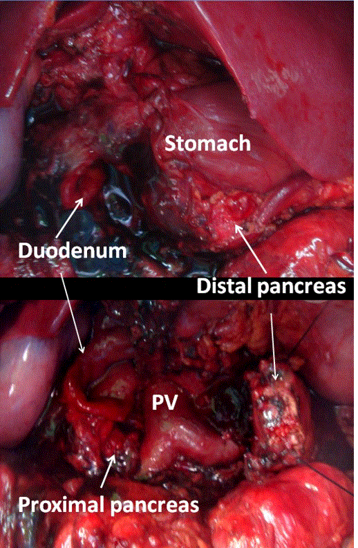 portion